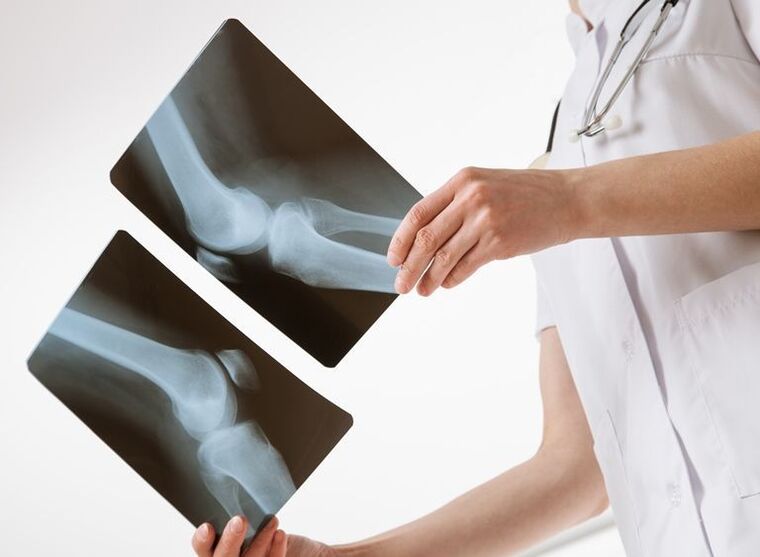 Diagnosis of joint pain