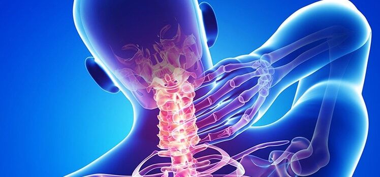 cervical spine degeneration
