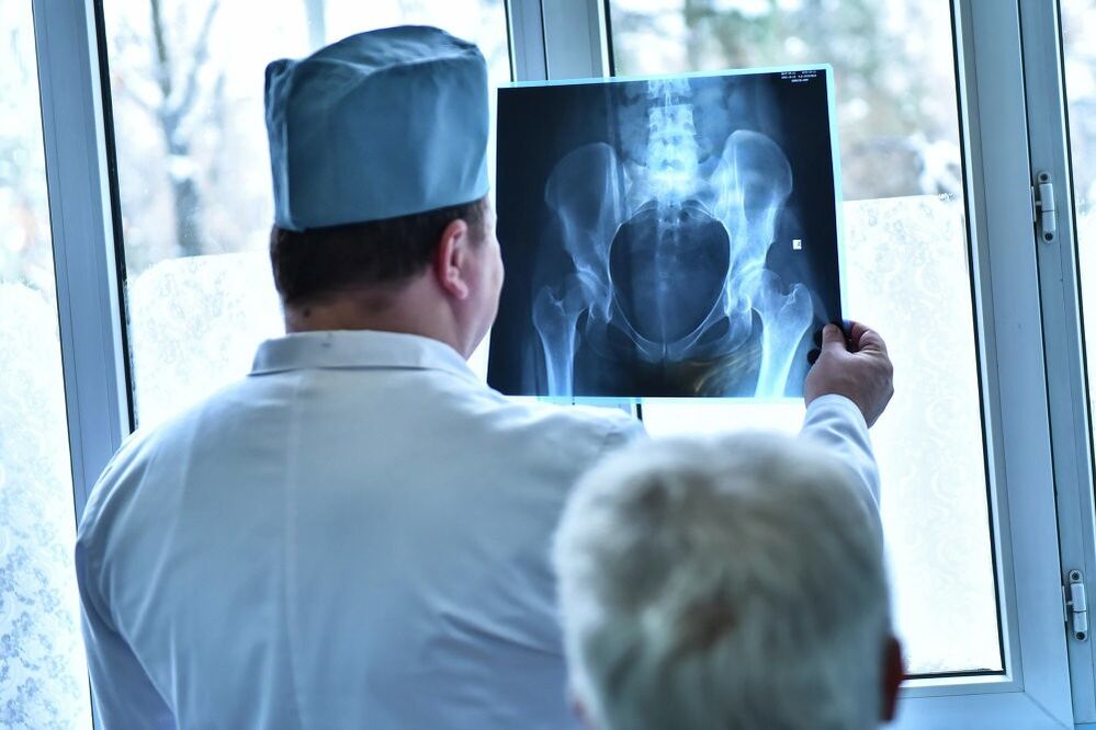 The doctor looks at the image of the hip joint with arthritis