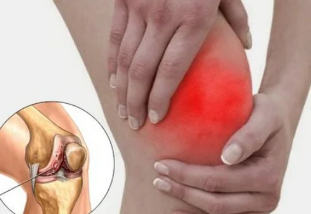 What happens if arthritis